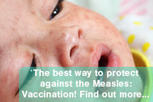 Closeup image of infant with measles. Overlay of text stating "The best way to protect against the Measles" Vaccinations. Find out more..."