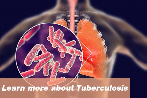 Learn more about Turberculosis
